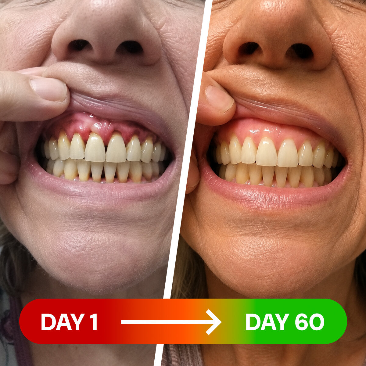 Reverse Receding Gums In Just 12 Minutes A Day...