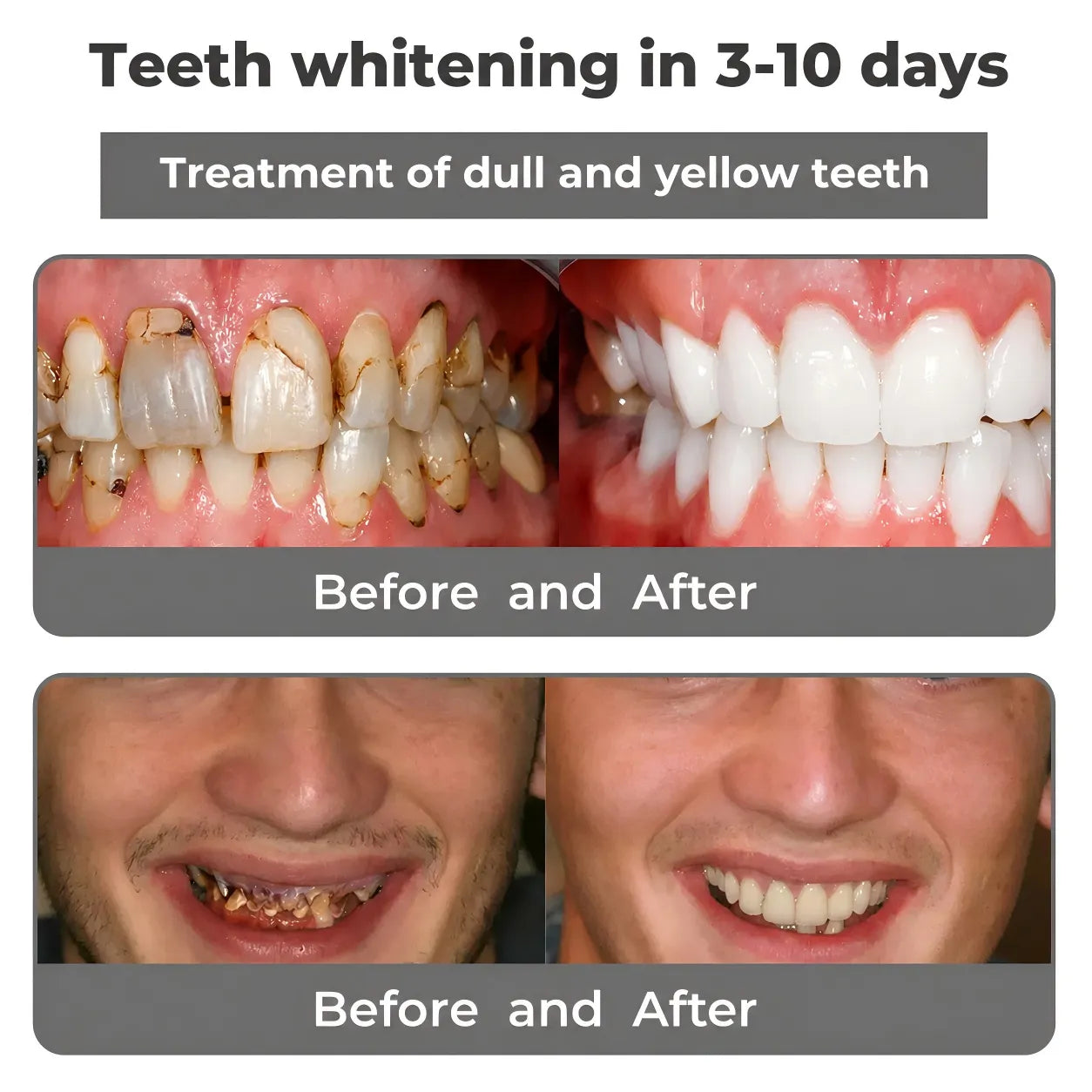 🦷YOYOLE® Bee venom &Nano-Hydroxyapatite Recovery + toothpaste >> 🔥Buy 1 Get 1 Free🔥🏆