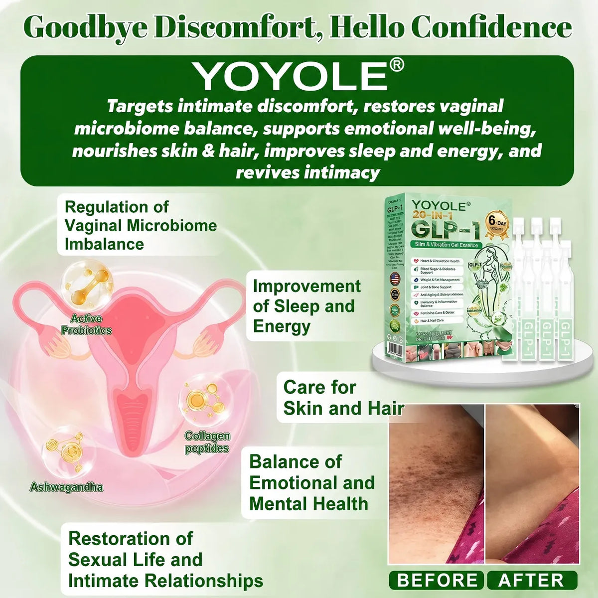 USCVS Online | YOYOLE® 𝗚𝗟𝗣-𝟭 𝟐𝟎-𝐢𝐧-𝟏 𝐒𝐥𝐢𝐦 & 𝐇𝐞𝐚𝐥𝐭𝐡 𝐎𝐫𝐚𝐥 𝐒𝐨𝐥𝐮𝐭𝐢𝐨𝐧 -𝑶𝒏𝒄𝒆 𝒂 𝒅𝒂𝒚, 𝒓𝒆𝒔𝒖𝒍𝒕𝒔 𝒊𝒏 6 𝒅𝒂𝒚𝒔, 𝑾𝒊𝒕𝒉 100 𝑩𝒊𝒍𝒍𝒊𝒐𝒏 𝑪𝑭𝑼 𝑨𝒄𝒕𝒊𝒗𝒆 𝑷𝒓𝒐𝒃𝒊𝒐𝒕𝒊𝒄𝒔 👨‍⚕️ 𝑺𝒖𝒑𝒑𝒐𝒓𝒕𝒔 𝒘𝒆𝒊𝒈𝒉𝒕 𝒎𝒂𝒏𝒂𝒈𝒆𝒎𝒆𝒏𝒕, 𝒉𝒆𝒂𝒓𝒕 𝒉𝒆𝒂𝒍𝒕𝒉, 𝒅𝒊𝒂𝒃𝒆𝒕𝒆𝒔, 𝒈𝒖𝒕 & 𝒘𝒐𝒎𝒆𝒏’𝒔 𝒉𝒆𝒂𝒍𝒕𝒉, 𝒘𝒉𝒊𝒍𝒆 𝒇𝒊𝒓𝒎𝒊𝒏𝒈 𝒔𝒌𝒊𝒏 & 𝒃𝒐𝒐𝒔𝒕𝒊𝒏𝒈 𝒆𝒏𝒆𝒓𝒈𝒚.