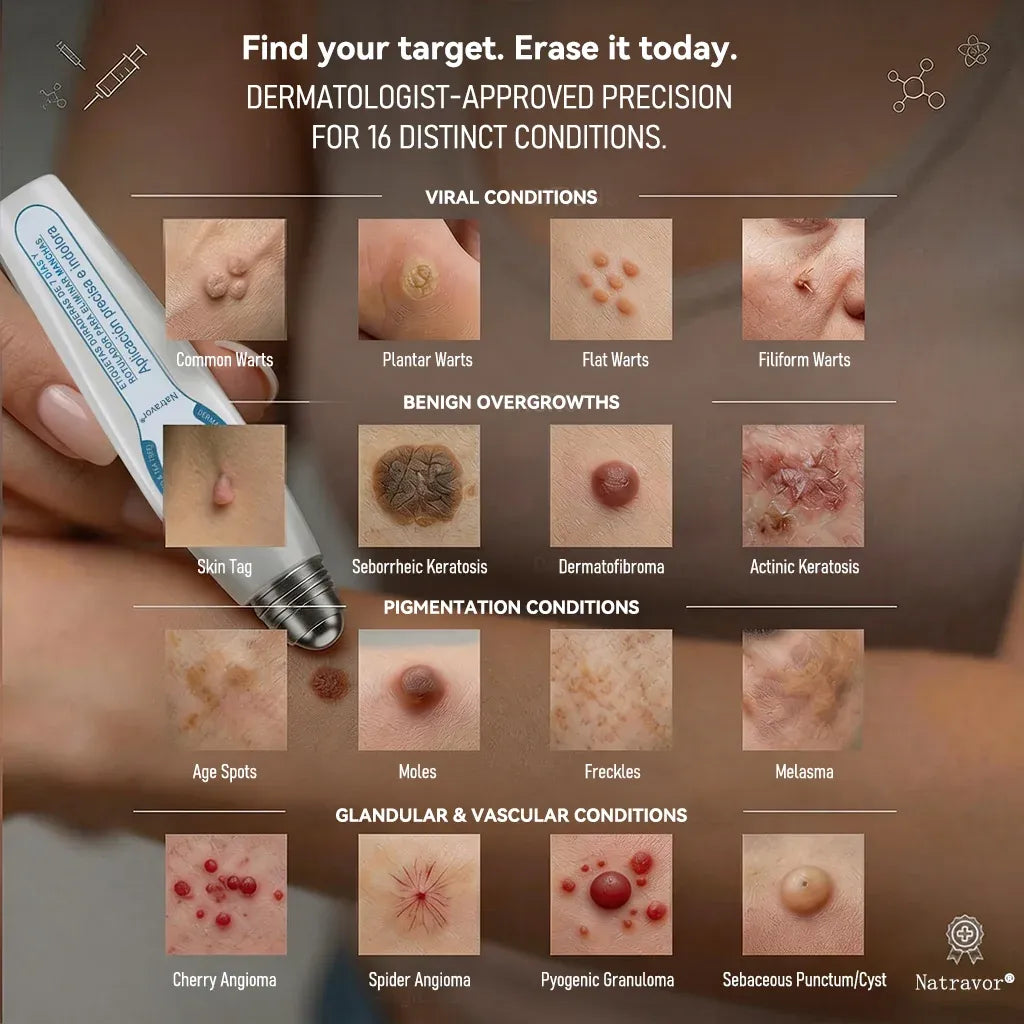 Professional Skin Tag & Spot Removal YOYOLE